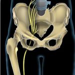 Sciatic nerve